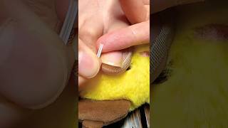👣 Say Goodbye to Painful Ingrown Toenails – Easy Fix with Smart Stickers ✨