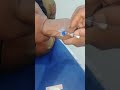 cannulation.. long video.. part 82 #cannula