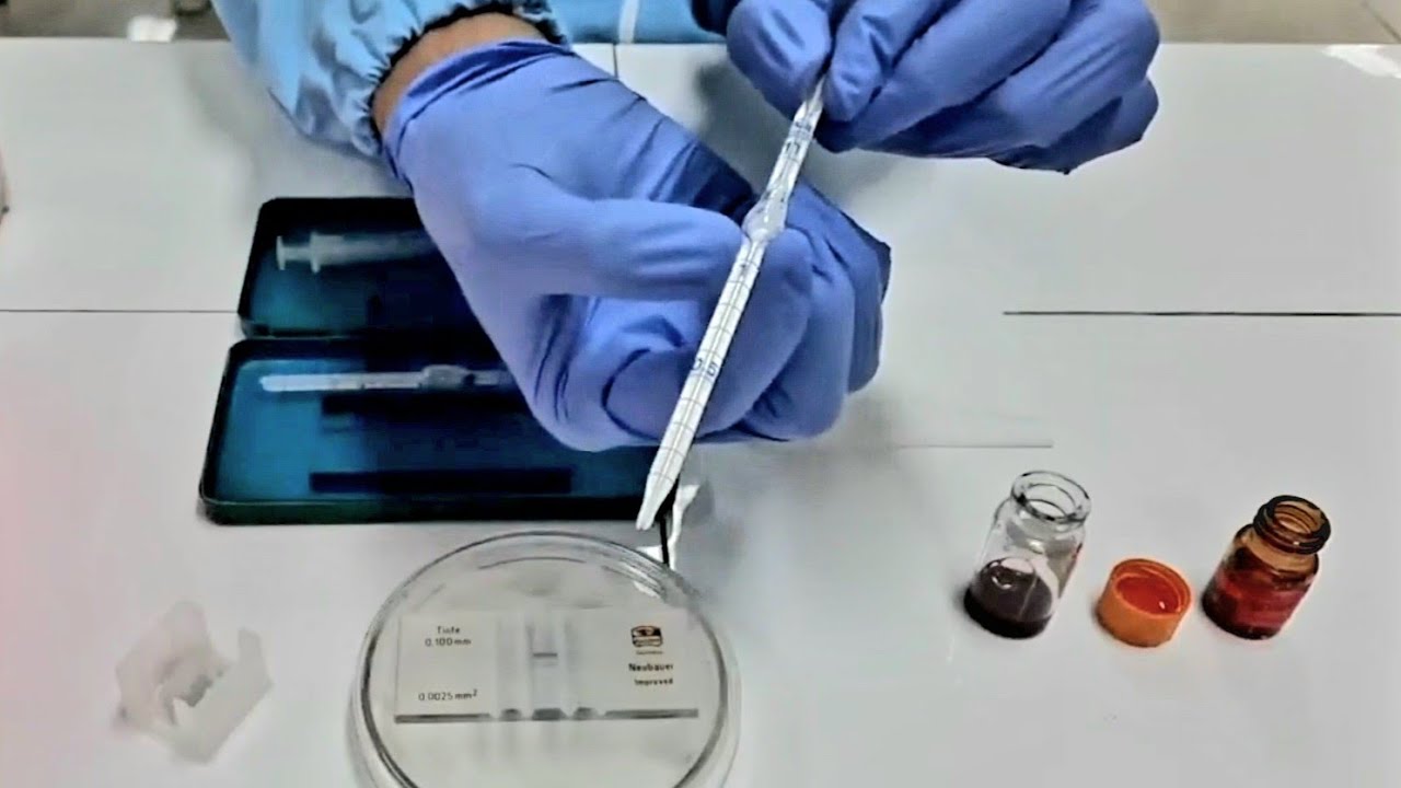 PEMERIKSAAN HITUNG JUMLAH EOSINOFIL