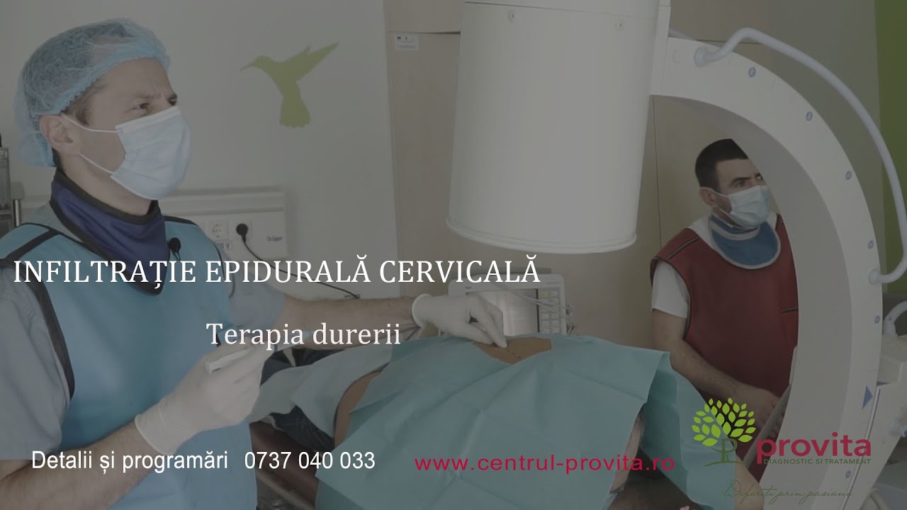 Infiltratia Epidurala Cervicala - Infiltratie ghidata fluoroscopic cu corticosteroizi