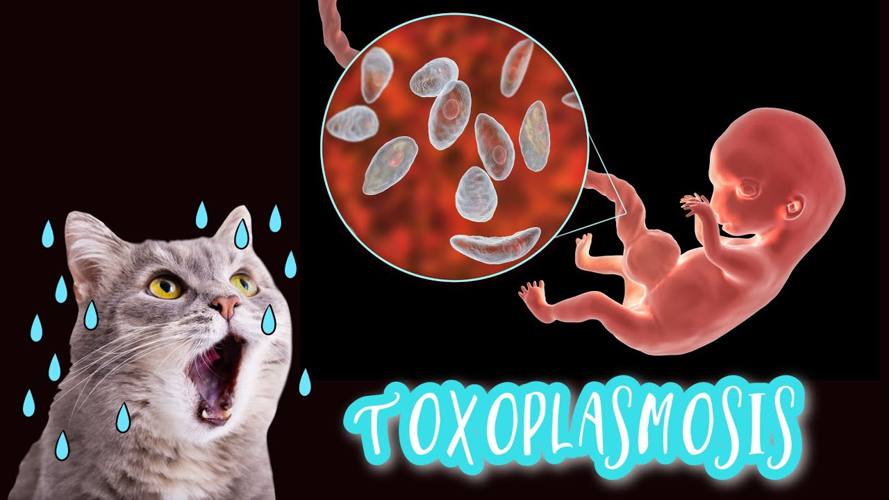 Zumo naranja embarazo toxoplasmosis