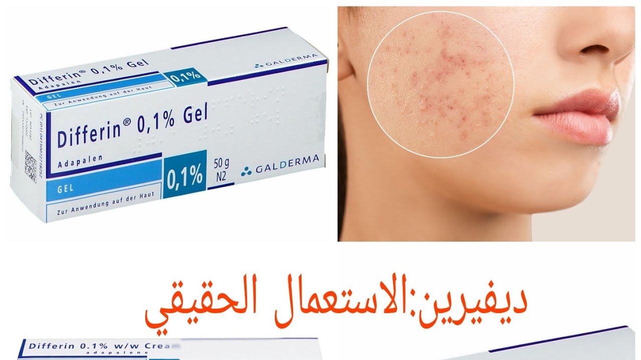 Differine crème et gel معالجة للبقع الداكنة وحب الشباب؟