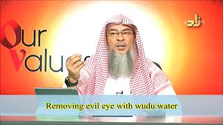 Removing Evil Eye With Wudu Water Sheikh Im Al Hakeem