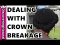 Dealing with Breakage in Crown of Hair and Crown Thinning