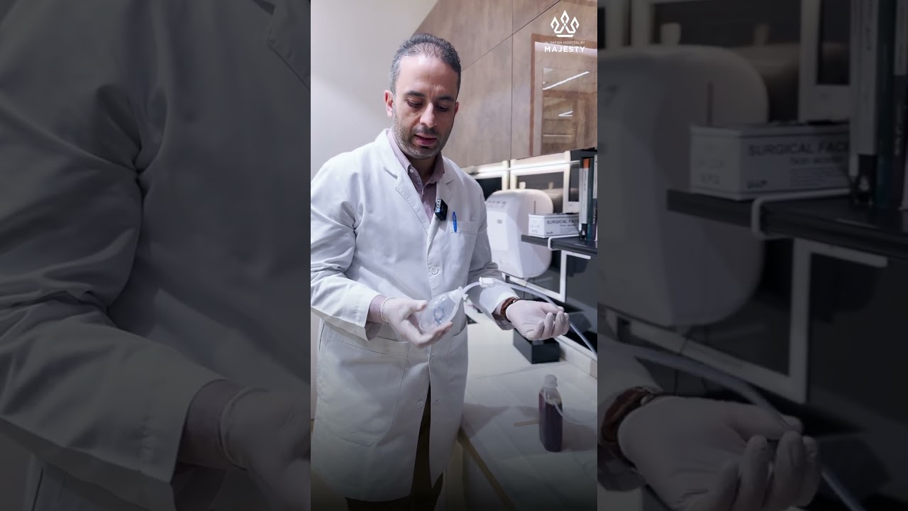 انبوب تصريف السوائل بعد العمليات الجراحية