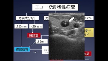 【Japan Cancer Forum2018】甲状腺がん ~甲状腺がんをよく知りよりよくつきあいましょう~