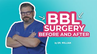 BBL Surgery Before and After