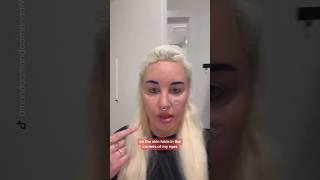 Amanda Bynes on her blepharoplasty surgery