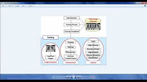 Covid 19 Detection using X Ray Images | Covid 19 Detection using X Ray Deep Learning