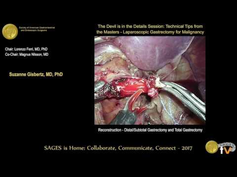 Laparoscopic Gastrectomy For Gastric Cancer: The Anastomosis