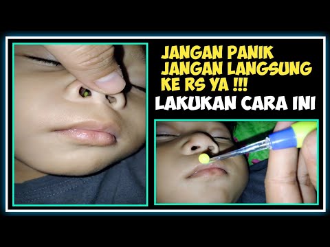 Video: Cara Menyapukan Anak Dari Memetik Hidungnya