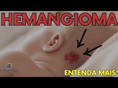 Vídeo: Quando as bochechas do bebê ficam vermelhas?