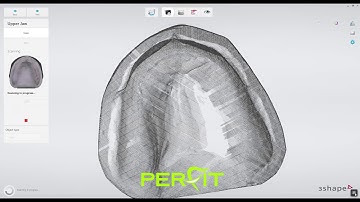 How to scan a wax-up with a 3Shape scanner