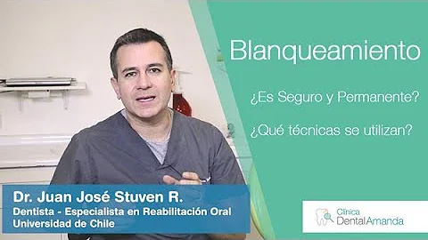 ¿Cuántos tonos se pueden blanquear los dientes?