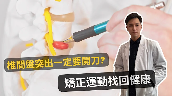 椎间盘突出一定要开刀!? 不用开刀的矫正运动及自我检查｜物治欧巴 Oppa physio - 天天要闻