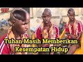 Inilah kisah hidup manusia tanpa otak