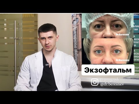 Экзофтальм. Чем поможет пластическая хирургия?