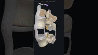 Ligamentum Falavum Hypertrophy