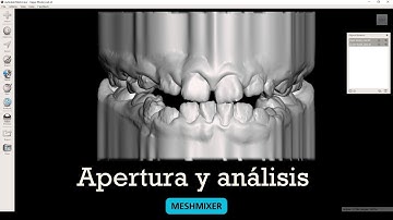 Apertura y análisis de modelos dentales en Meshmixer