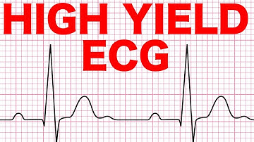 Electrocardiograms (ECG) Made Easy!