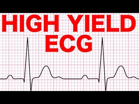 electrocardiograms-(ecg)-made-easy!