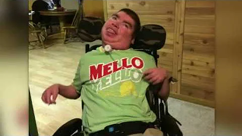 Meet Cole Kelemen, Oldest Man with Miller-Dieker S...