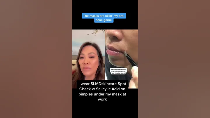 My Spot Check patches are back in stock on slmdskincare.com! #shorts #youtubepartner #slmdskincare