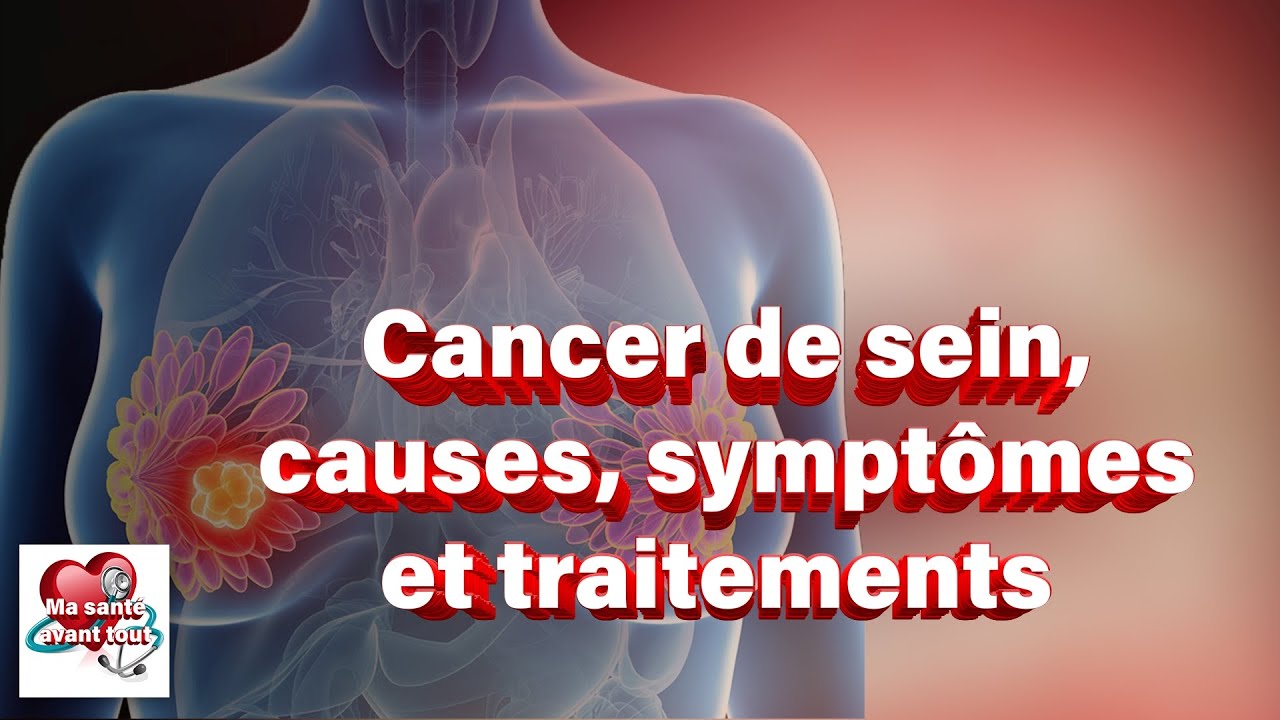 ️Le cancer de sein, découvrez les causes, symptômes et traitements ️ ️ — free download