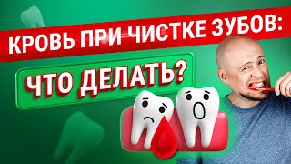 Кровоточат десна при чистке зубов: что делать?