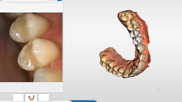 Mastering Digital Dentistry: Full Upper Jaw Scan with Primescan and CEREC SW 5