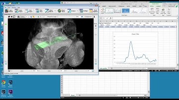 FluoRender: Analyzing density