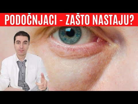 Video: 3 načina da izbjegnete natečene oči ujutro