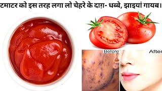 DIY TOMATO CREAM |SKIN WHITENING CREAM|TOMATO CREAM FOR FACE|REMOVE DARK SPOTS,WRINKLES ,ACNE-SCARS