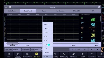 Part5 Mindray N Series User Training Reviewing Patient Data HR