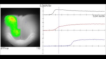 Voltage Sensitive Dye Imaging using MiCAM05-N256