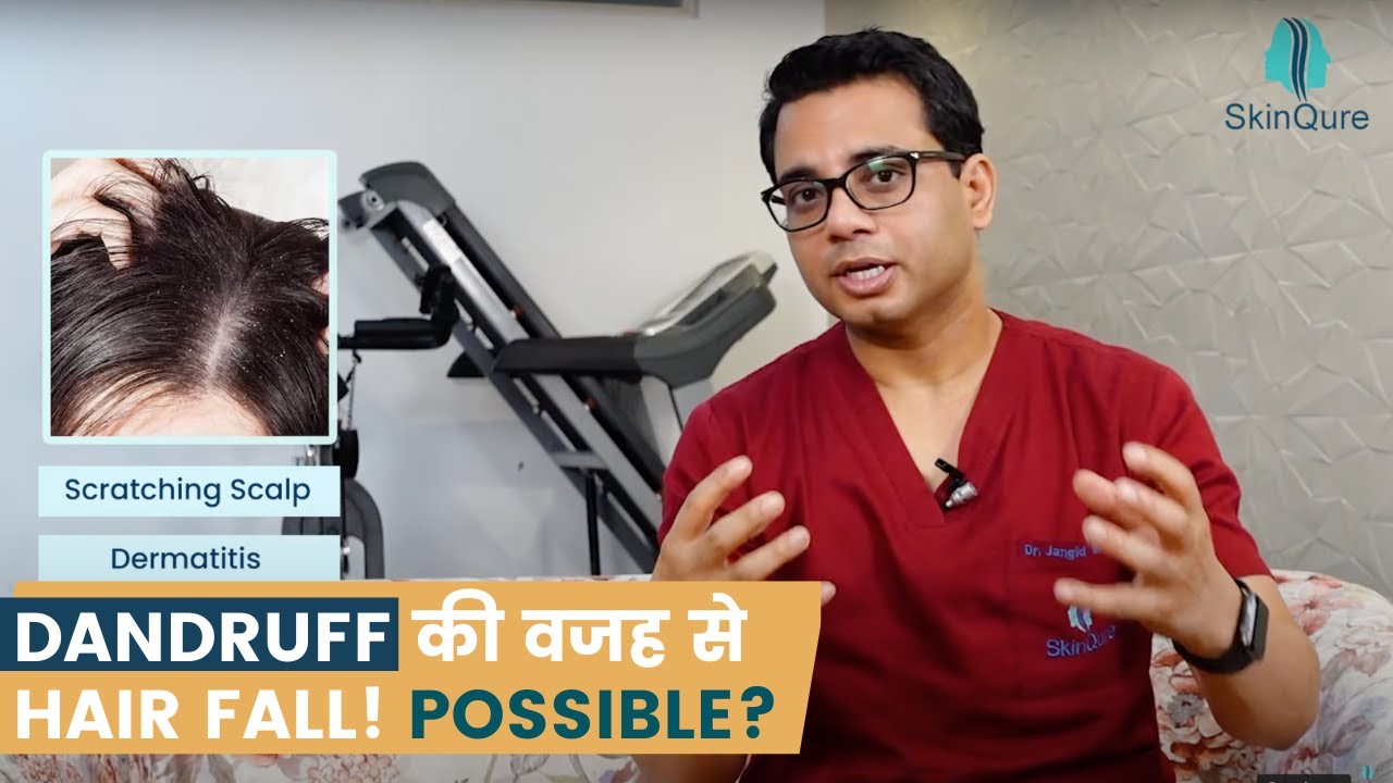 क्या Dandruff की वजह से Hair Fall हो सकता है? | Anti-Dandruff | Hair  Regrowth treatment in Delhi - YouTube