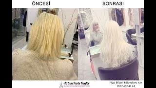 Görünmez Saç Kaynak Öncesi & Sonrası & Müşteri Yorumu