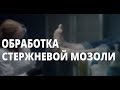 Обработка стержневой мозоли