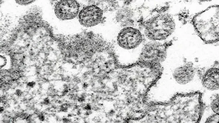 Health experts issue warning: Coronavirus is not the same as the flu