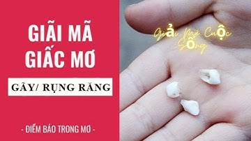 Nằm mơ thấy rụng răng là điềm gì?