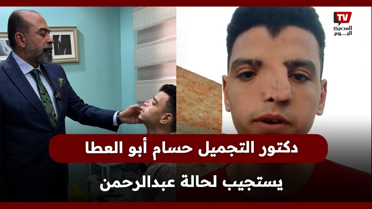 بعد معاناته لمدة 20 سنة.. دكتور التجميل حسام أبو العطا يستجيب لحالة عبد الرحمن  هيبقى زى الفل