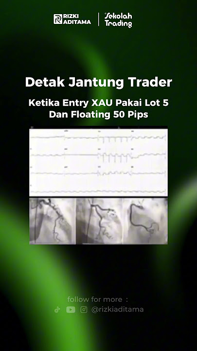 Detak Jantung TraderKetika Entry XAU. #shorts #trading #forex