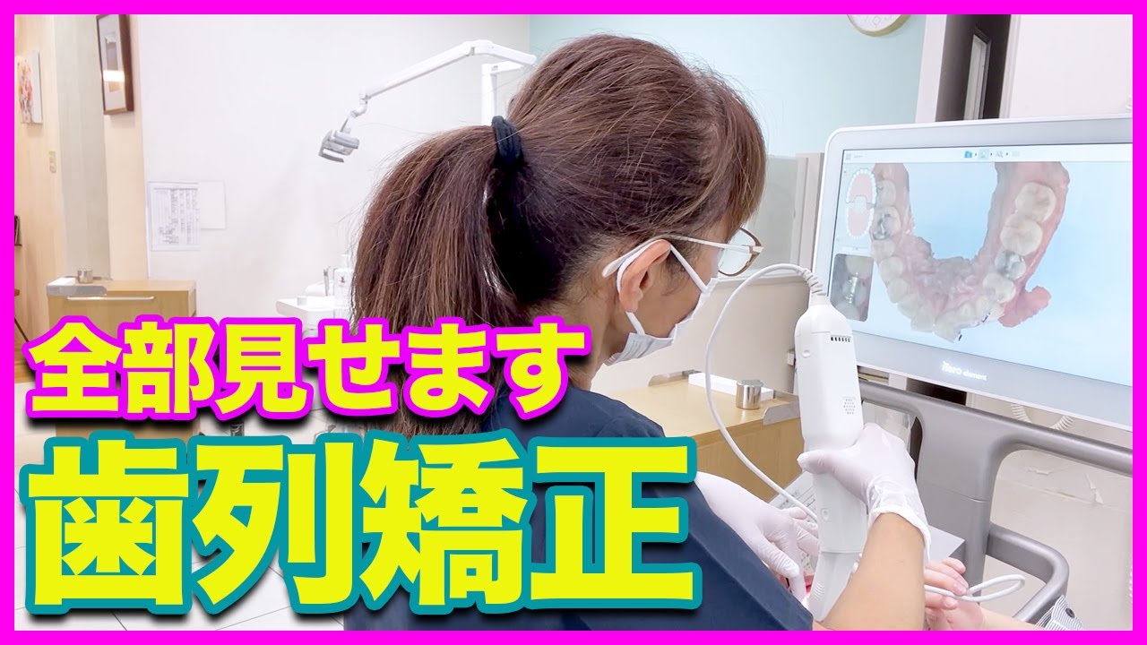 全部見せます】歯列矯正はじめます！精密検査の流れまで大公開！ - YouTube