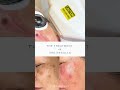 the treatment vs. the results ✨🧡