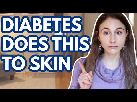 Video: Je nystatin dobrý na kožní onemocnění?
