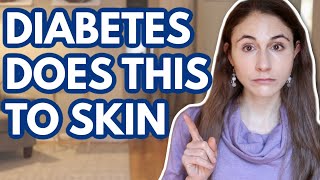 WHAT DIABETES DOES TO YOUR SKIN // DERMATOLOGIST @DrDrayzday screenshot 3