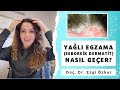 Yal egzama nasl geer seboreik dermatit tedavisi  dr ezgi zkur