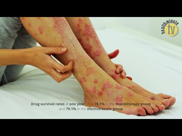 VIDEO: Concomitant methotrexate adds no benefit to PsO treatment compared to adalimumab monotherapy