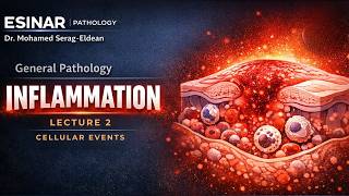 Inflammation | 2- Cellular Events