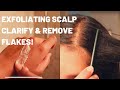 EXFOLIATING SCALP - How I Exfoliate Wet & Dry